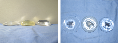 Breast Implant Profiles photo